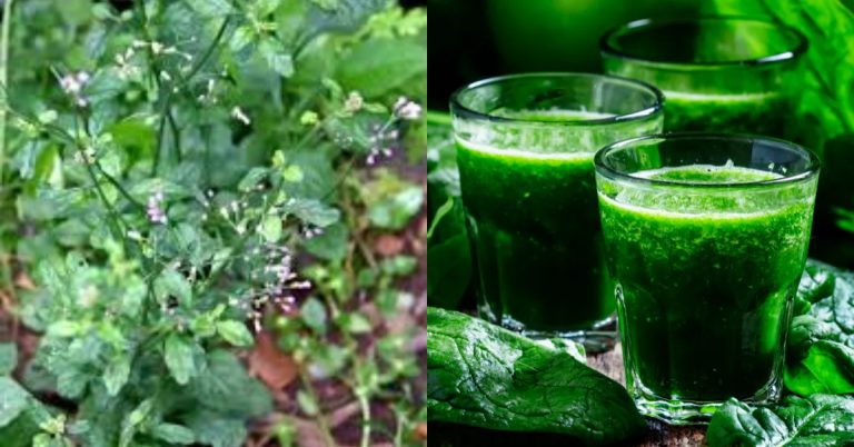 migraine relief at naturally