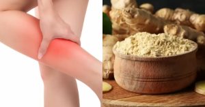 vein prevention tips