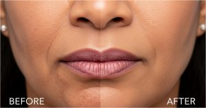 How-to-Remove-Pigmentation